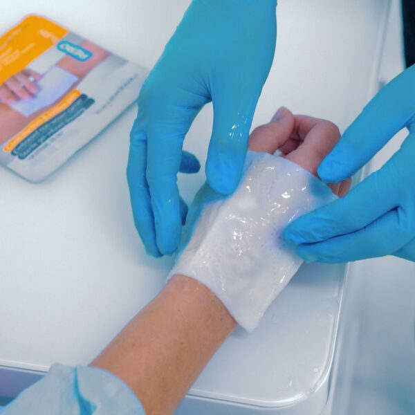 AEROBURN Burn Gel Dressing 10 x 10cm
